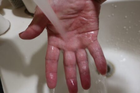 びしょびしょに濡らした手の画像