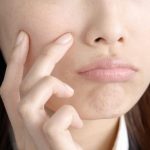 不機嫌そうに頬の吹き出物を抑える指と顔の画像