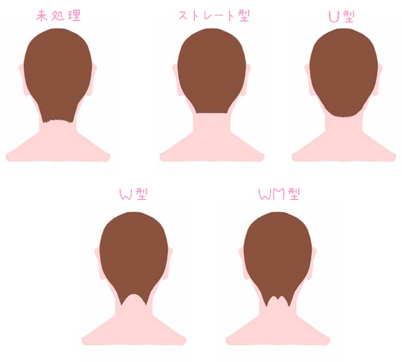 うなじの形　5パターン　図解