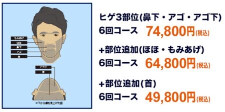 ゴリラクリニック　部位と料金　図解